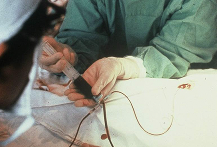 交換輸血にはどのようなリスクがありますか?